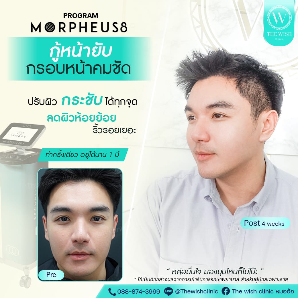 morpheus1
